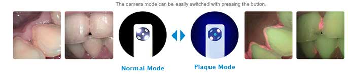 RFSYSTEMLab Plaque detection imaging - Einstein Spark