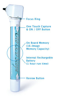 m-16 otoscope details