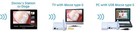 Rf SYSTEM Lab wireless dental camera and monitor system