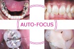 RFSYSTEMLab - Einstein Lumica - Auto Focus