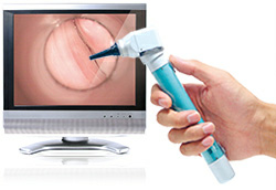 wireless video otoscope ME-16