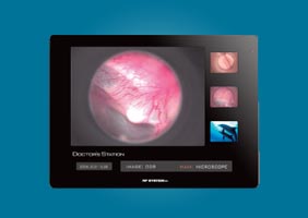 RFSYTEMLab Wireless medical cameras and monitors