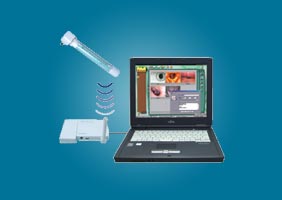 RFSYTEMLab Wireless medical video otoscope cameras and monitors